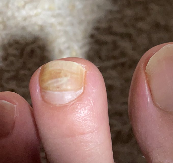 深爪のtwitterイラスト検索結果 古い順