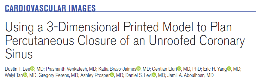 Eric H Yang, MD (@datsunian) on Twitter photo .Highlighting probably one of the coolest, multidisciplinary #cardioonc #ACHD cases just published online in <a href="/CircImaging/">CircImaging</a>!
Led by <a href="/uclaCVfellows/">UCLA Cardiology Fellowship</a> #bruinhearts grad <a href="/dustintlee/">Dustin Lee</a>, now <a href="/UCLAHealth/">UCLA Health</a> faculty
1/
ahajournals.org/doi/10.1161/CI… .Highlighting probably one of the coolest, multidisciplinary #cardioonc #ACHD cases just published online in <a href="/CircImaging/">CircImaging</a>!
Led by <a href="/uclaCVfellows/">UCLA Cardiology Fellowship</a> #bruinhearts grad <a href="/dustintlee/">Dustin Lee</a>, now <a href="/UCLAHealth/">UCLA Health</a> faculty
1/
ahajournals.org/doi/10.1161/CI…