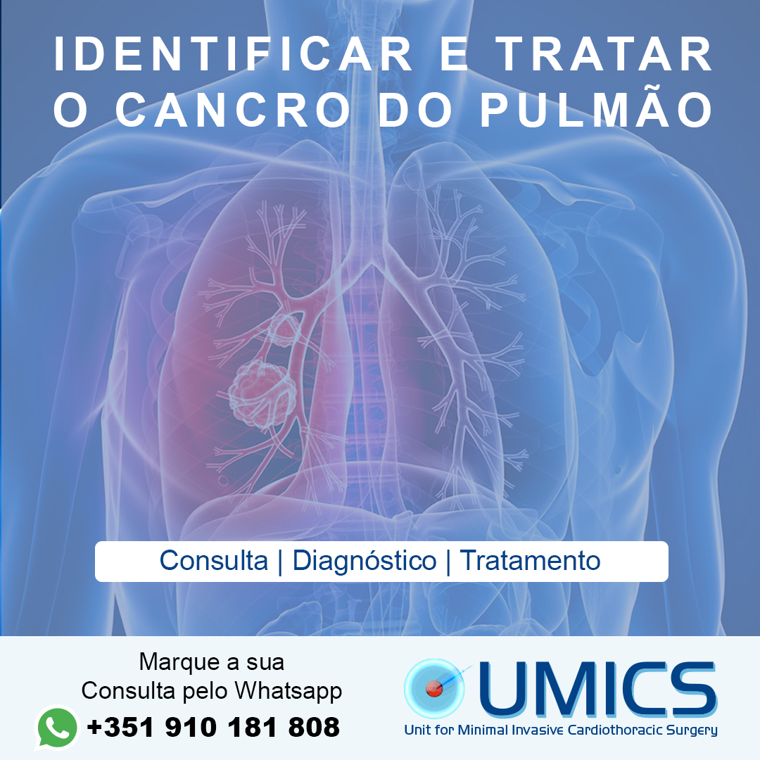 UmicsSurgery's tweet photo. O cancro no pulmão é o segundo tipo de câncer que mais cresce no mundo, sendo superado apenas pelo número de casos de cancro da pele.

Para mais informações, ligue ou deixe mensagem pelo Whatsapp +351 910181808. Saiba mais em: https://t.co/cq2E2Dsa8K

#CirurgiaMinimamenteInvasiva https://t.co/wGwP3FBh4Q