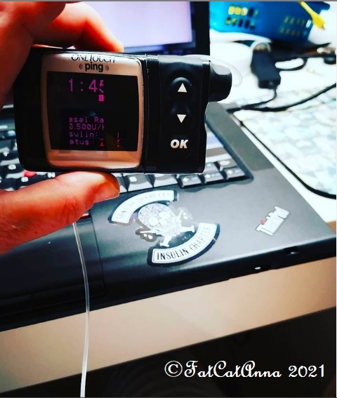 FatCatAnna's tweet image. Back on a tubed pump ... bye bye @myomnipod until I can afford you again ... more scribbles from moi at this link - instagram.com/p/CUVMProlcbu/ #insulin4all #animasping #level55 #diabadass #technology #T1Dlookslikeme #Health