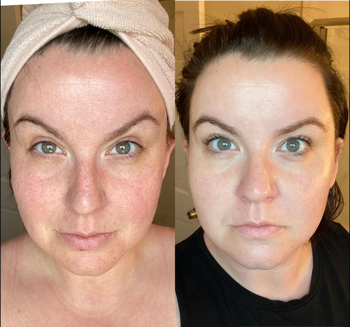 This is a top leader with #Bellame  She's been using our skincare line for 1.5 years, so her skin was already gorgeous. On the right was after adding our #beautyboost #Collagen  . The lemon lime tastes amazing. Check it out: 
Bellame.com/leslie1