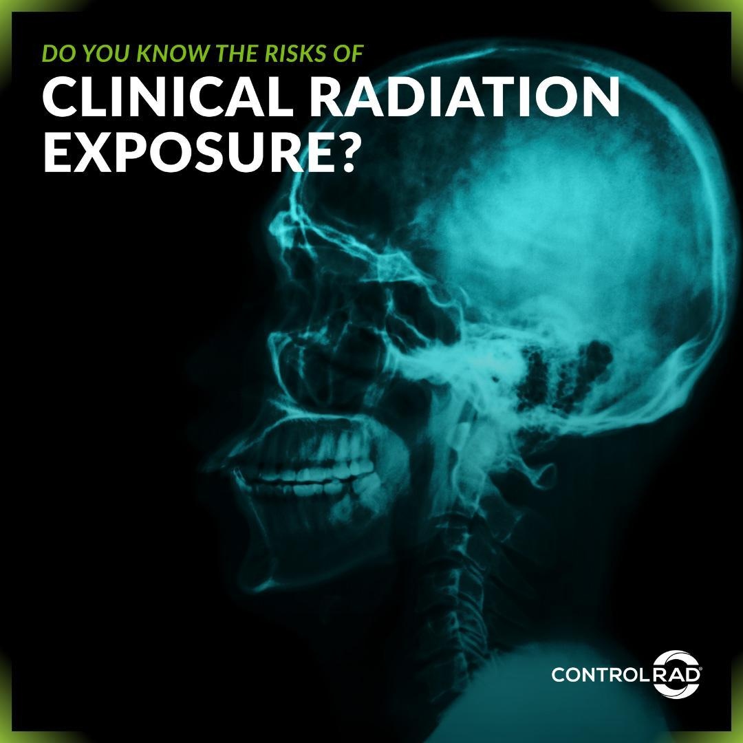 radiation exposure x-ray testicle radiation exposure x-ray testicle