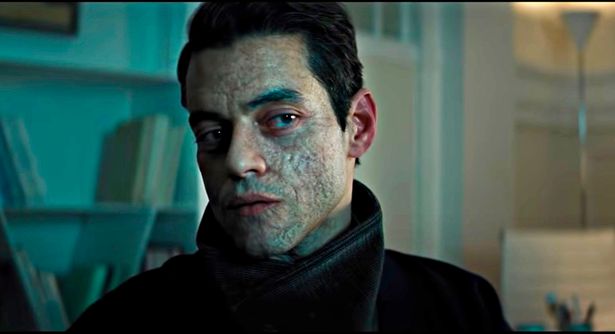 THREAD

Every time a new James Bond film is made, the producers are asked to reconsider their representation of disfigurement. Every time, they say they don't care. The new film, out this week, is no exception. This time, two villains with facial disfigurements. Lucky us.