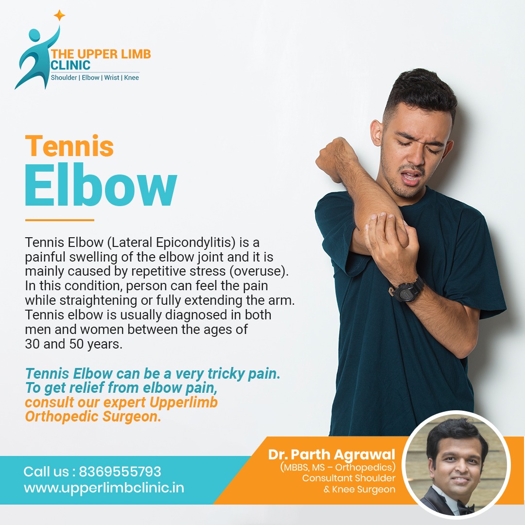 ClinicLimb's tweet photo. 𝐓𝐄𝐍𝐍𝐈𝐒 𝐄𝐋𝐁𝐎𝐖

To schedule appointment, Call at: +𝟗𝟏 𝟖𝟑𝟔𝟗𝟓𝟓𝟓𝟕𝟗𝟑

For more information visit: https://t.co/DFEUD0ObIE

Visit Clinic: https://t.co/kLVpaVut3Y https://t.co/vTxAuv3Rf5