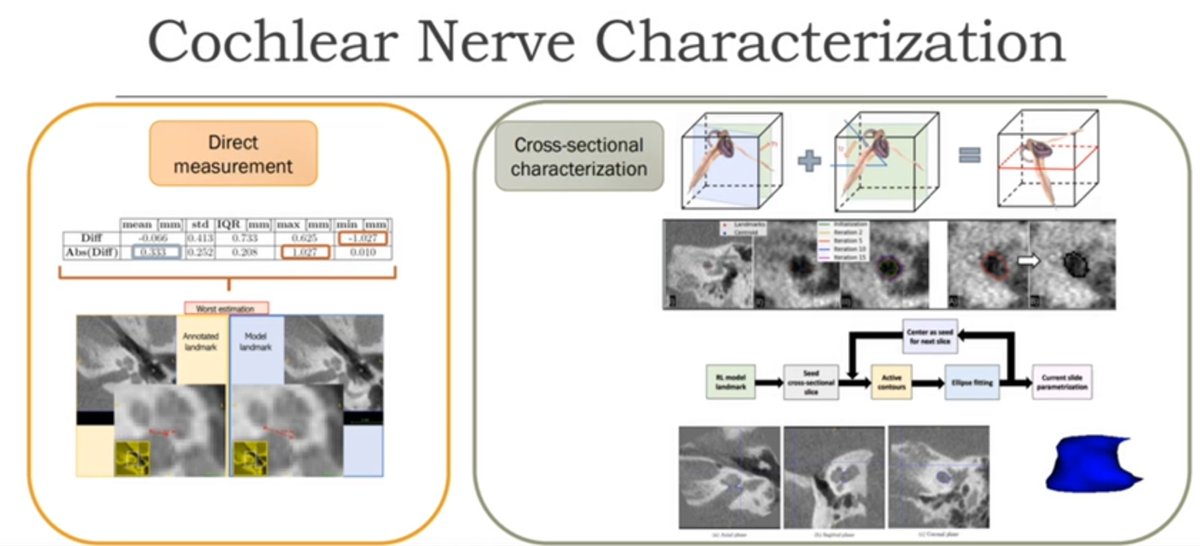 jmargeta's tweet photo. ⚡️Time to reinforce some 🐌 nerves #MICCAI2021⚡️ 
Our Paula López Diez presents: "Facial and cochlear nerves characterization using deep reinforcement learning for landmark detection"
With @JosefineLl @FrancoisPatou Rasmus R Paulsen @OticonMedical @DTU_Compute @kardiome https://t.co/bVhLFLvOL8