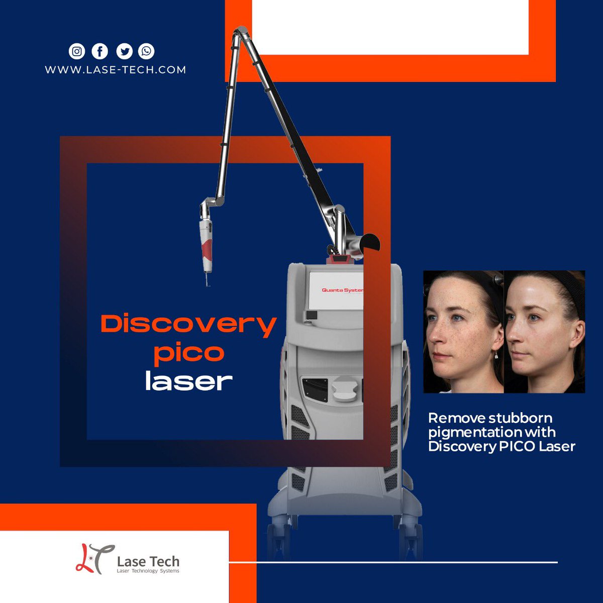 laseTechsystems's tweet image. Effective for removing stubborn pigmentation, acne scars, and tattoos for skin rejuvenation and brightening

Lase-tech.com

#discoverypico #picolaser #quanta #quantalaser #tattooremovalspecialists #dubai #كوانتا #picosecond #dubaiclinic #quantasystem #بيكو