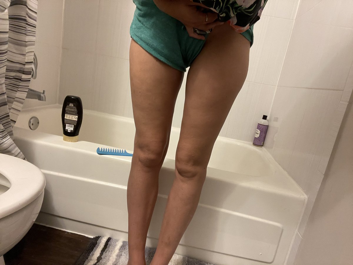 OGsufferer's tweet image. Please kill me. Holy shit. I’m down 3 pounds but where 😂