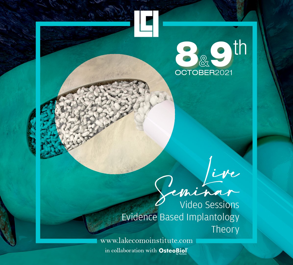 LComoInstitute's tweet photo. Join us for a live seminar on #MaxillarySinusAugmentation on Oct. 08-09, 2021 with Prof. Tiziano Testori and Prof. Marco Esposito.
💥 This educational path will present both evidence-based and new state-of-the-art techniques.
📲 https://t.co/2tZUukThZe 
#LCI #education https://t.co/W9YuNN61Vu