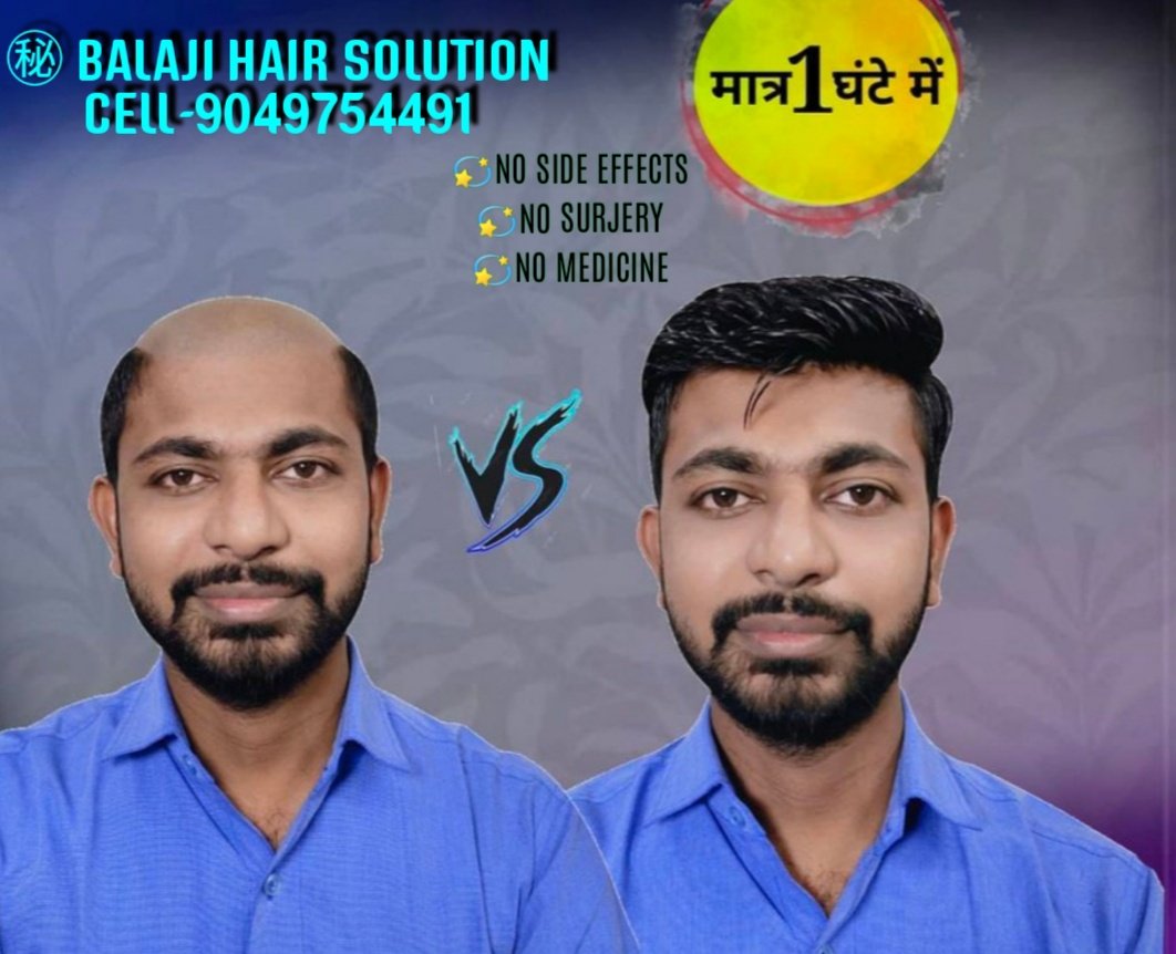 Balaji Hair Replacement & Wig(patch)Center Nashik on Twitter: Balaji Hair Replacement & Wig(patch)Center Nashik on Twitter: