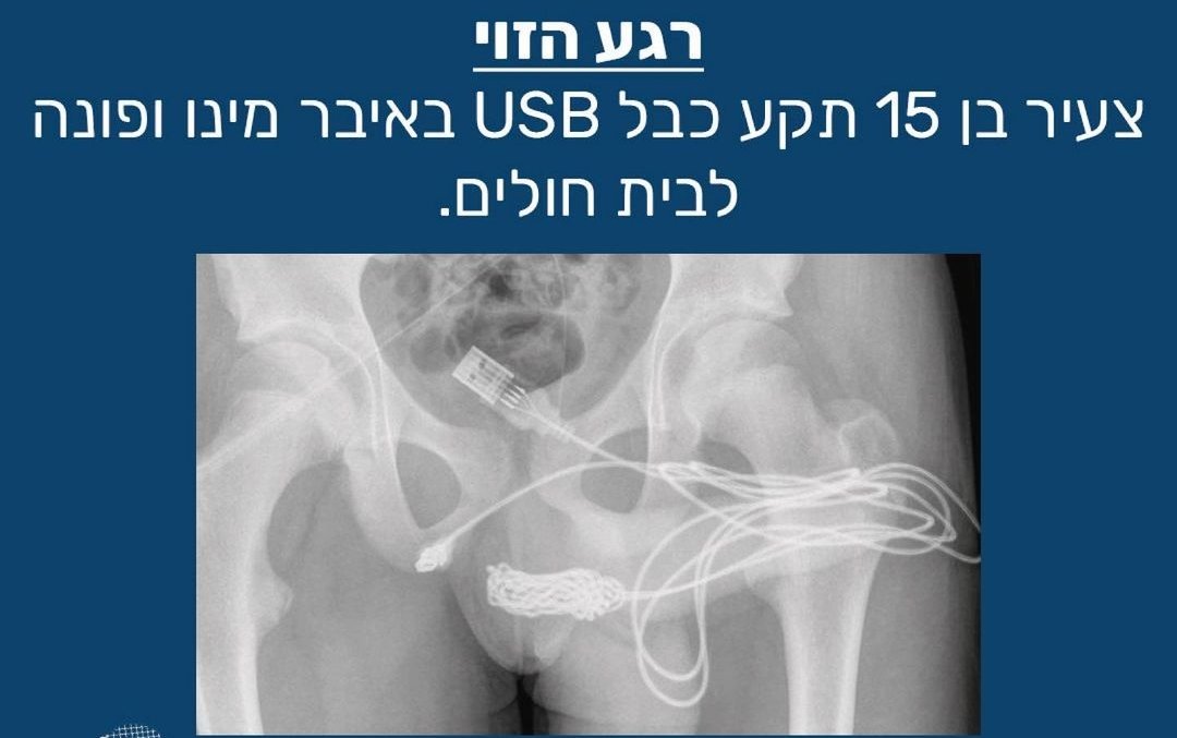 (הברווז הזה) tweet media