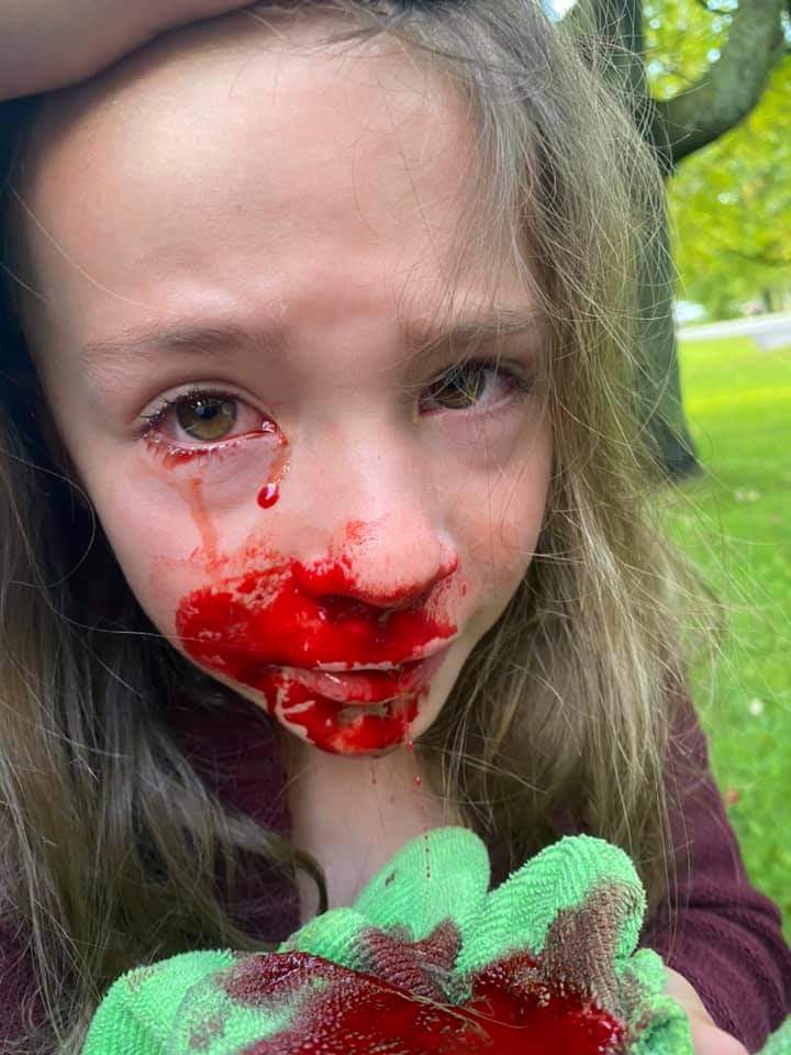 BLNewsMedia's tweet photo. Young girl eager to return to school needs nasal swab test. Mom says 30 minutes after returning home, bleeding from eye and noise. Public health allegedly stated this is "normal." https://t.co/kfv0JjPXBS