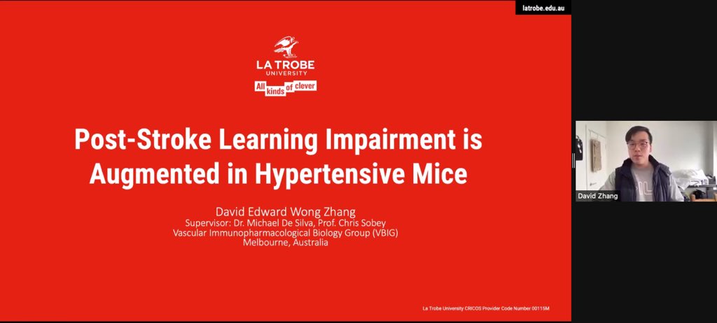 Hypertension is a modifiable risk factor for stroke &amp; cognitive impairment. <a href="/dwongzhang/">David Wong Zhang</a> @CCBDR_LTU studies if this affects post-stroke cognitive outcomes. He found that the combination of hypertension &amp; stroke led to greater learning impairment. Interesting work David! #ANZMS2021
