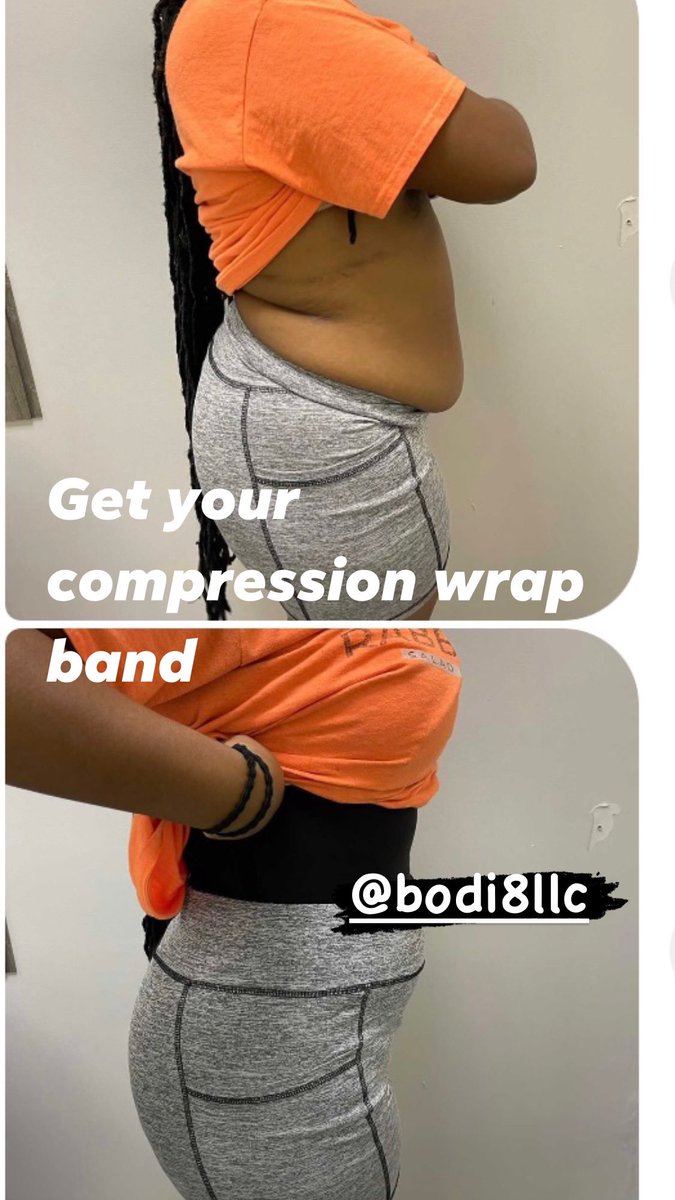 ArielSingleto16's tweet photo. Compression Wrap Band‼️.     Before &amp; After 💗 https://t.co/IxhWlsojqo https://t.co/z6vwmwedEb