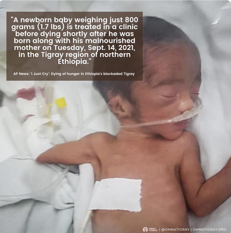 banaozil204's tweet photo. .@UN called it a “de facto aid blockade” but has barely done anything to avert the famine. When will global leaders step in to relieve human suffering? Children are dying. Ethiopia &amp; Eritrea must be sanctioned. #TigrayCantWait @KenyaMissionUN @USAmbUN  https://t.co/D6Hsq529Mk