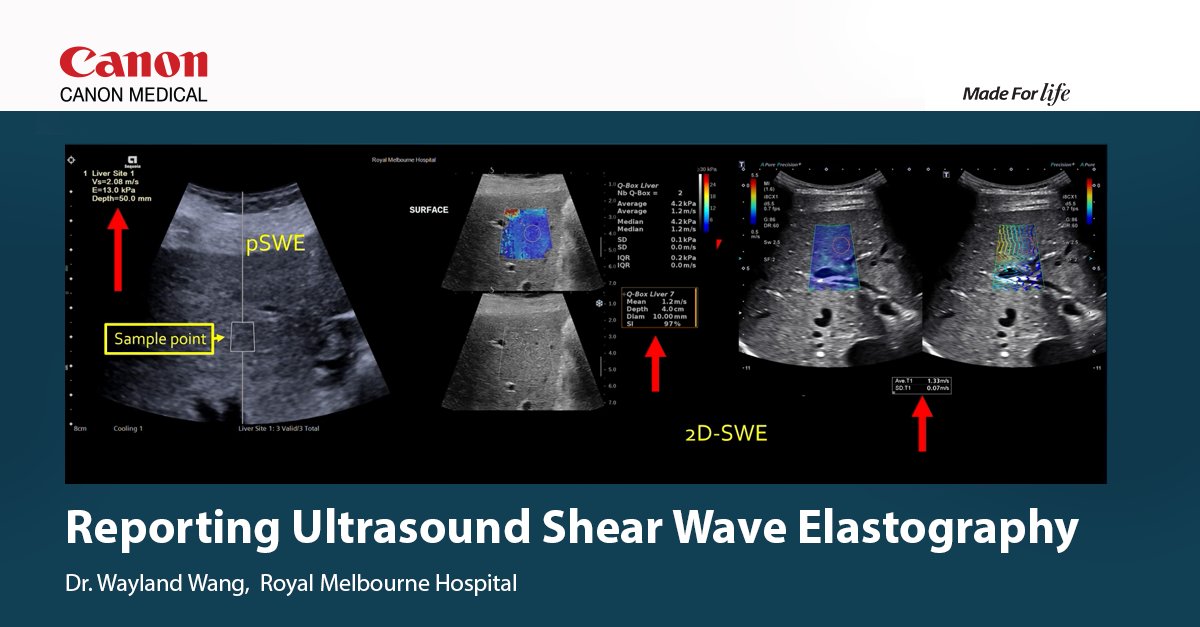 CanonMedicalANZ's tweet photo. Watch Dr Wayland Wang from the Royal Melbourne Hospital present on the reporting aspect of a #ShearWaveElastography examination. https://t.co/twJstX3231 https://t.co/hRXLMN8xak