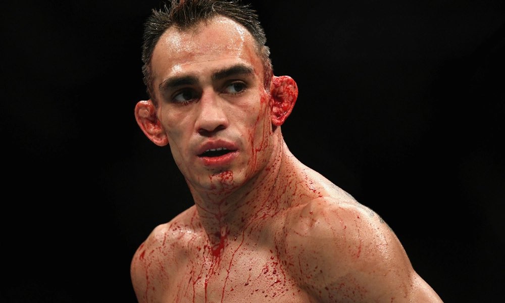 AquaFighting's tweet photo. Tony Ferguson vs Nate Diaz will be announced on September 29th 2021

Bookmark it. https://t.co/77x0ScCqbz