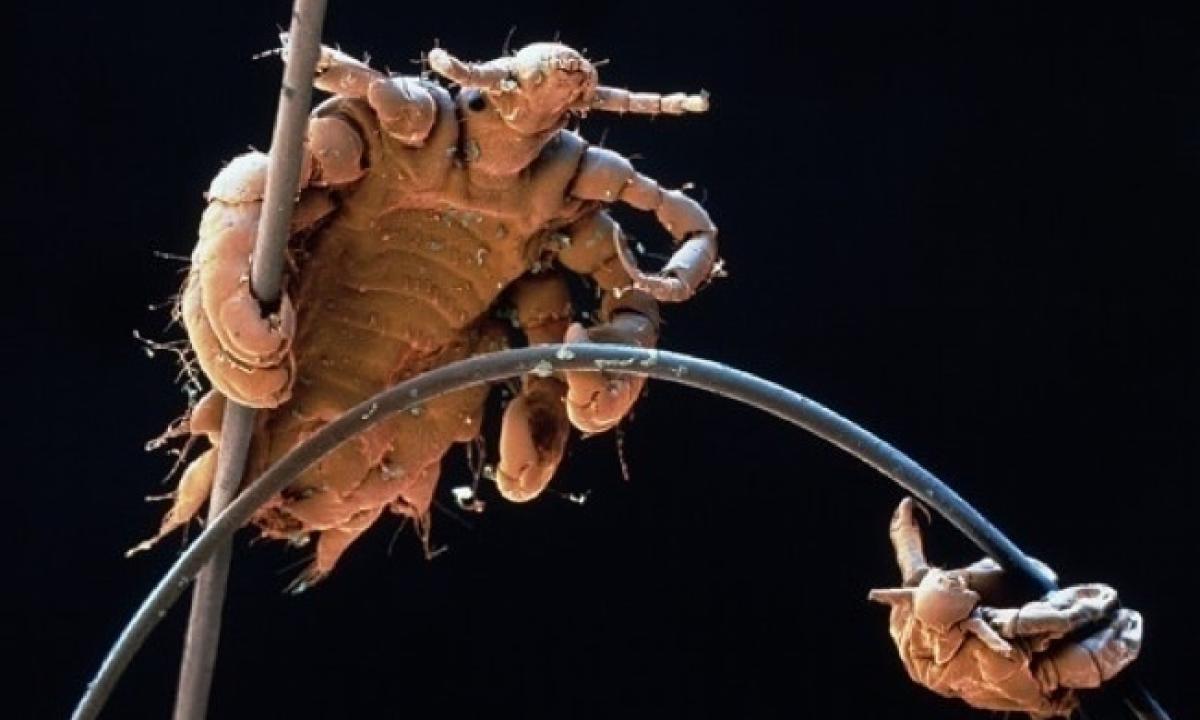 🔬Elektron mikroskobu ile çekilmiş bit fotoğrafı