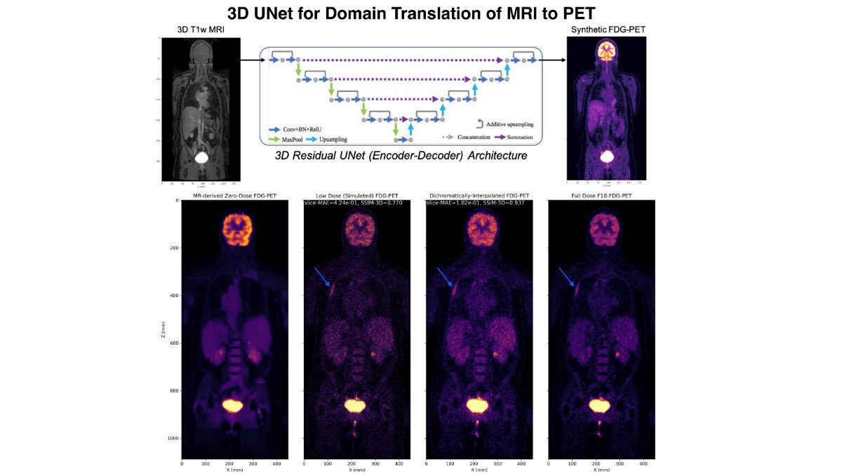 Blog post about how my team has been trying to solve reconstruction problems for #PETMR systems using (what else but) … DEEP LEARNING 😁

Instrumental contributions from post docs @absudabsu @ndwork !

A couple new papers should be out soon - stay tuned