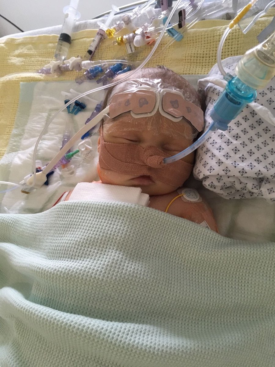 splugen31's tweet photo. #WorldHeartDay2021 

From heart surgery at 12 days old to a happy, healthy and thriving little girl. Thanks to the #NHS and @team_1c @HeartCentreAld1 @DrRamanaCardiac and of course Raphael Guerrero. Incredible people who do incredible things. We are forever grateful. @TheBHF https://t.co/BY10vlH9OG