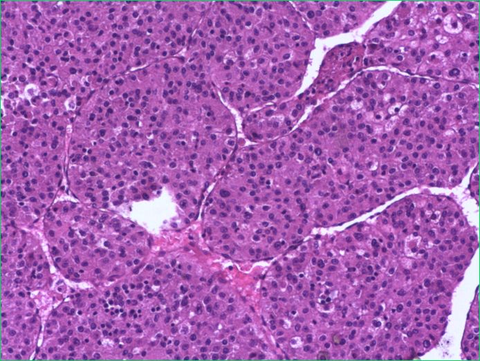 my_ueg's tweet photo. Got a histopathology report but don’t know what you are looking for? 🔬 Join our #UEGWeek session Feast your eyes: MDT image trivia to learn how a case can be dealt from different perspectives, using a multidisciplinary approach. https://t.co/wOlp1mXNHx https://t.co/reHV5E44Yy