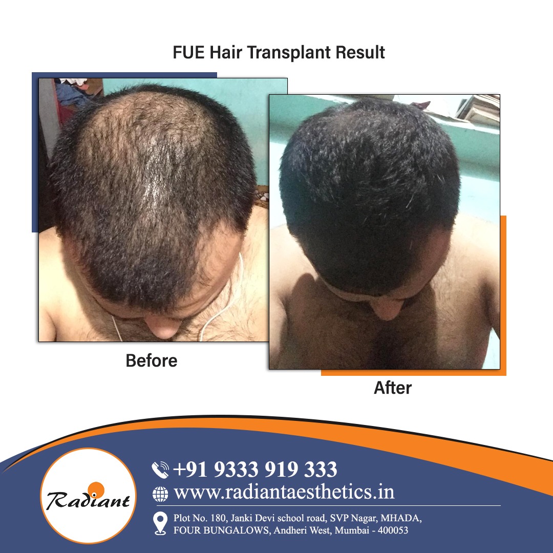 Radiant Aesthetics Clinic (@RadiantClinic) / Twitter Radiant Aesthetics Clinic (@RadiantClinic) / Twitter