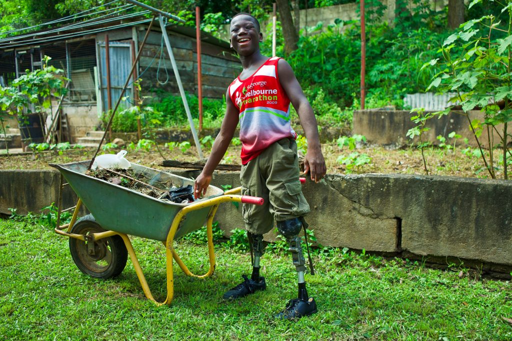 The #Diabetes Show with <a href="/PeterAllton/">Peter Allton</a> <a href="/circlepodiatry/">Circle Podiatry</a> <a href="/beundefeeted/">Undefeeted</a> on <a href="/ukhealthradio/">UK Health Radio™</a> - Evie Dickinson of UK charity @legs4africa who source, recycle &amp; reuse #lowerlimbprosthetics to give #amputees back their independence #mobility &amp; often livelihoods.

👉🏼bit.ly/3xZ5C1A