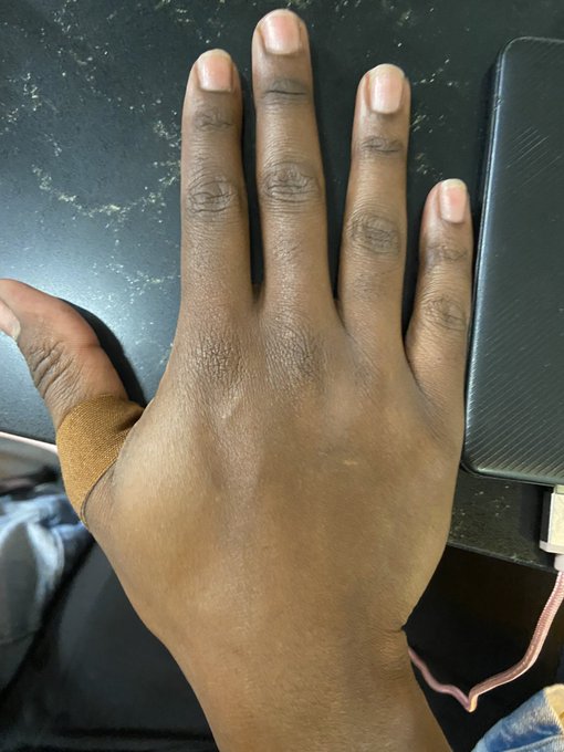 ?BROWN BANDAIDS FINALLY? https://t.co/3CCQTiLtEe