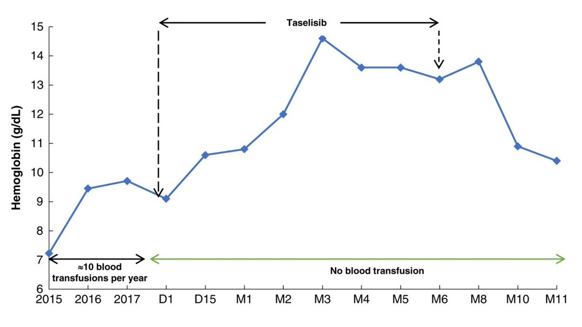 Genetics in Medicine (@gimjournal) on Twitter photo An update on the treatment of PI3KCA-related overgrowth spectrum bit.ly/3uuYObW <a href="/pierrevabres/">Pierre Vabres (moi/je)</a> <a href="/mbardou/">Marc Bardou</a> #Genetics An update on the treatment of PI3KCA-related overgrowth spectrum bit.ly/3uuYObW <a href="/pierrevabres/">Pierre Vabres (moi/je)</a> <a href="/mbardou/">Marc Bardou</a> #Genetics
