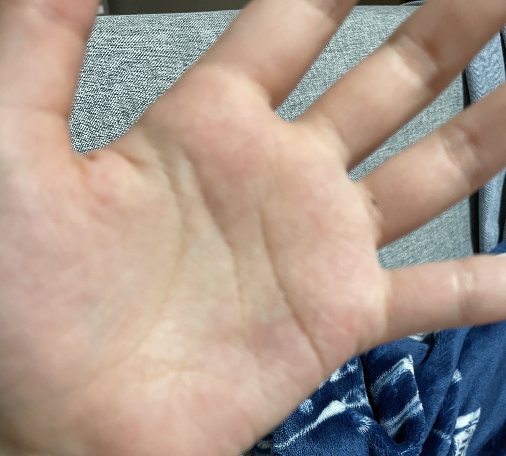 Yuuuuuuuu こーじが前に雑誌で言ってた えんぴつがささって色が残った話 この薬指のやつ それなら もう運命よな 私も小学生の時刺さって 未だ 26歳 に刺青のように残っとる笑 まじ 本人に伝えたい笑 Snowman 向井康二 同じところに鉛筆の芯