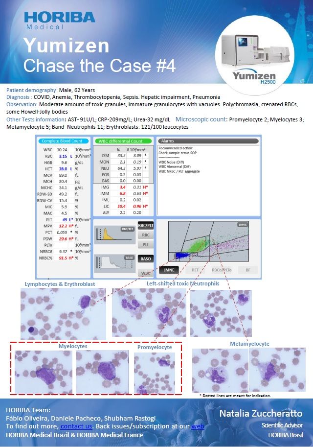 horibamedical's tweet photo. The 4th #ChaseTheCase is about the #COVID and #sepsis infection and its impact on #hematology analysis. LMNE matrix of Yumizen H2500 is in correlation with digital images of the cells. Download the clinical case and subscribe at: https://t.co/efW7eFPETJ
#yumizen #haematology https://t.co/9lTbVznsiL