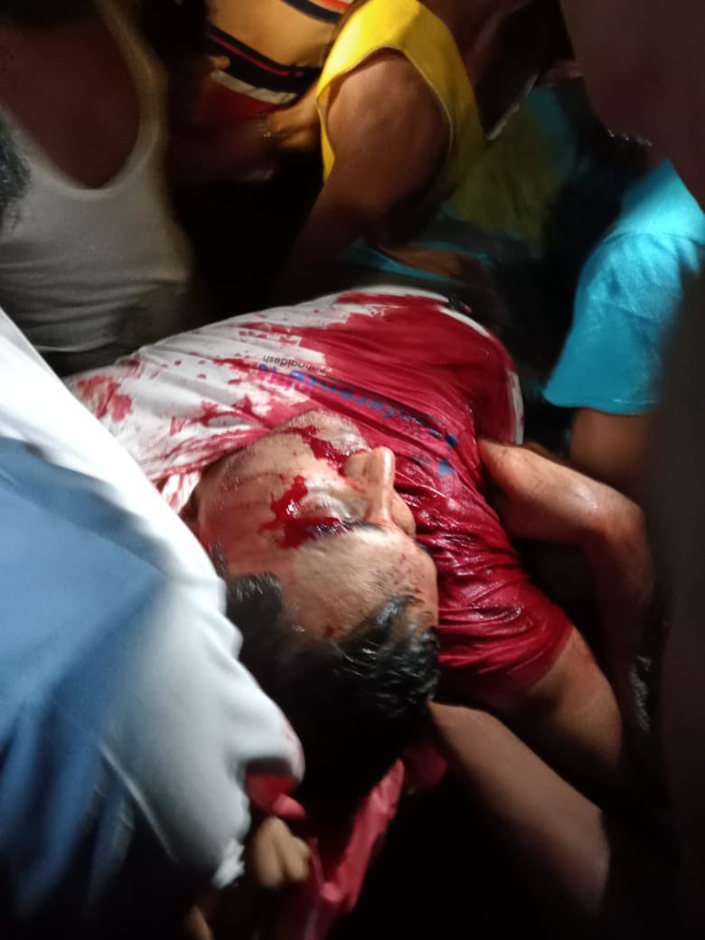 **Sensitive**

Image of dead body of Master Mohibullah. Shot today In Kutupalong #Rohingya #refugee camp.