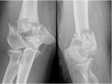 Ortho_Reviews tweet picture