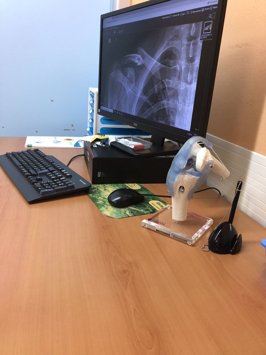 kaaluin's tweet image. Surgery tomorrow. Wish me luck! #brokenbones