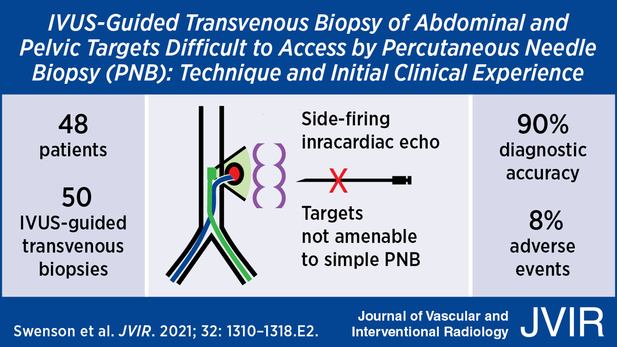Intravascular Ultrasound-Guided Transvenous Biopsy of Abdominal and Pelvic Targets Difficult to Access by Percutaneous Needle Biopsy: Technique and Initial Clinical Experience ow.ly/FpRz50Gat7O #irad