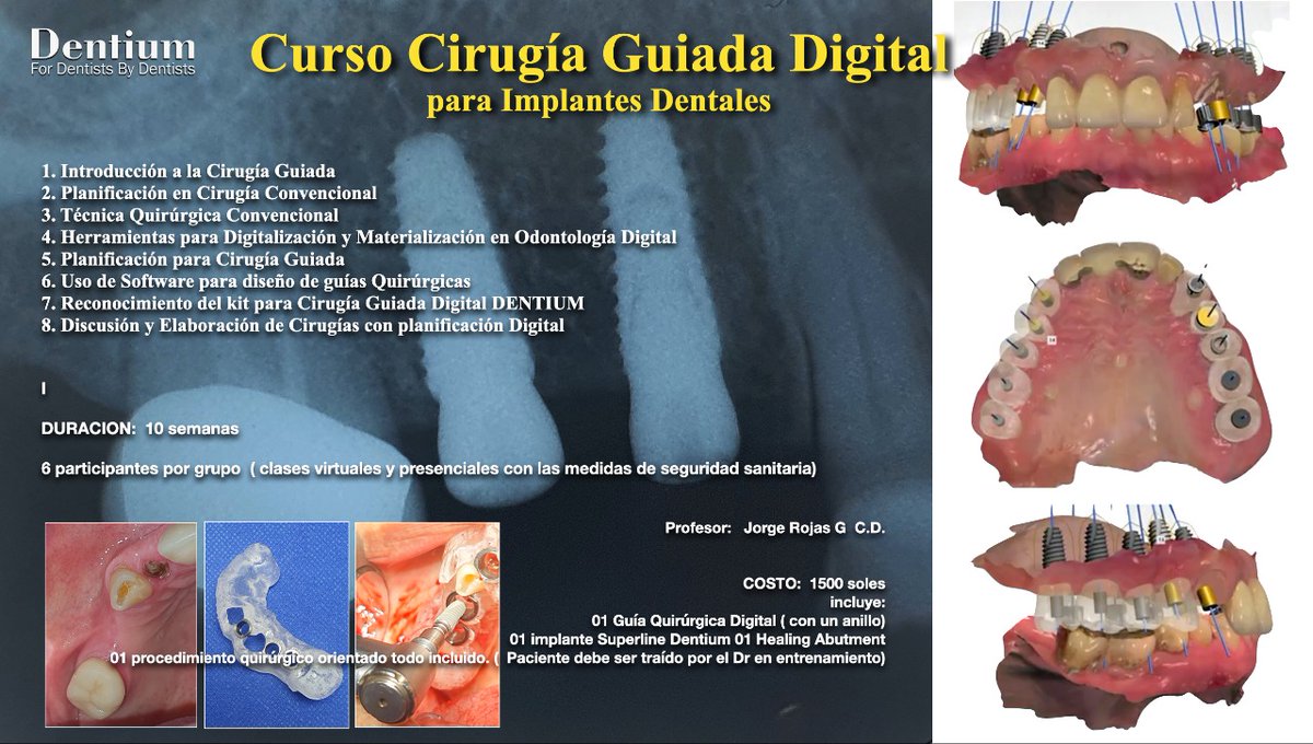 DentiumT's tweet photo. Amigos odontólogos no pueden dejar pasar este increíble curso que hemos preparado para ustedes🤤😎

El Curso de cirugía guiada digital para implantes dentales.

✅Consulta con nuestros asesores comerciales
+51 919471604
#odontologia #dentiumcideas #cursos #dentalimplants https://t.co/VcIDrxNEJH