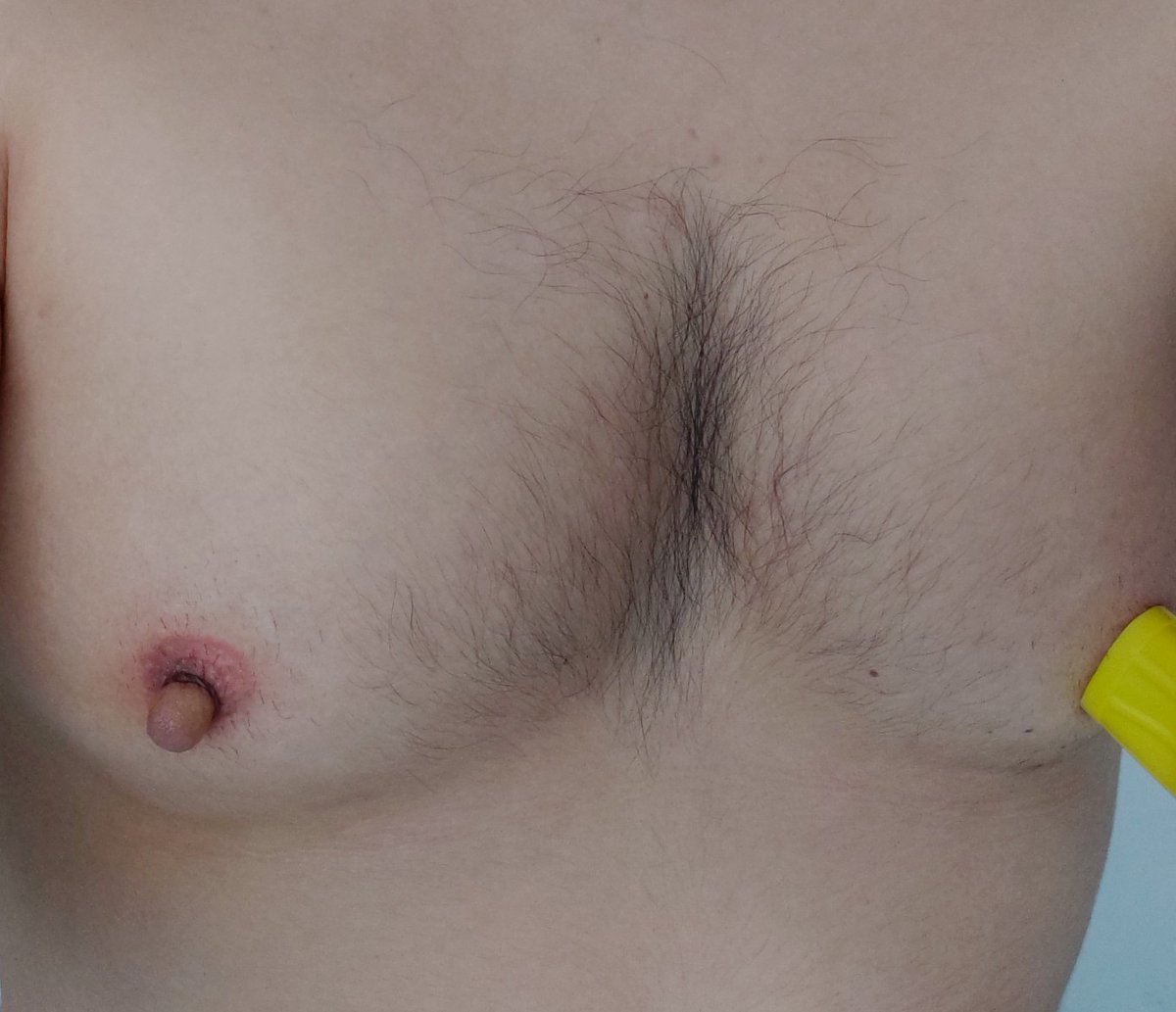 some more pumping with the snake bite kits