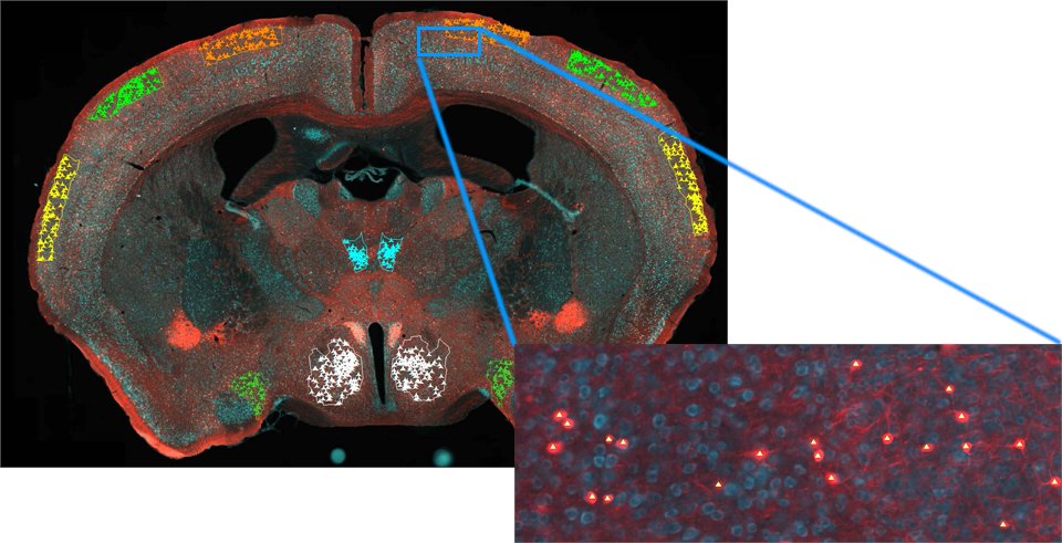MBFBioscience's tweet photo. The latest version of #NeuroInfo has been released!
NeuroInfo is the most advanced software available for automatically aligning #SerialSections and mapping cell counts to a #standardized reference space.
Try out Version 2021.1.4 for yourself! https://t.co/eFCyCKsSnM https://t.co/LssYVnMBrJ