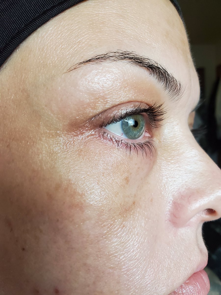 grown_alberta's tweet photo. @CassBankson I just needed to say Thank You!! Your videos on skin care have helped me SOOOOO much! My skin is looking soooo much healthier and it's due to your advice. I'll be 40, next year and I finally feel confident in my bare skin... These pics have no filters on! https://t.co/uY8dIERskE