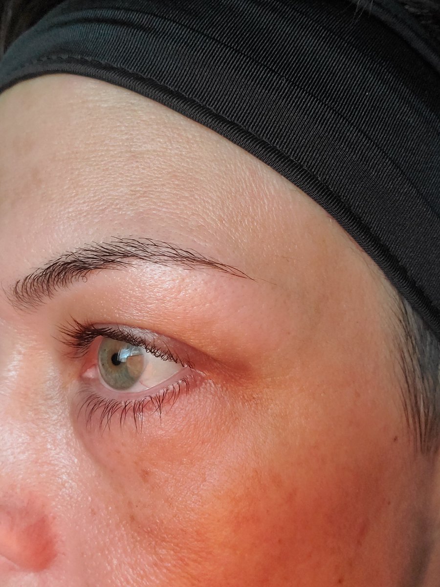 grown_alberta's tweet photo. @CassBankson I just needed to say Thank You!! Your videos on skin care have helped me SOOOOO much! My skin is looking soooo much healthier and it's due to your advice. I'll be 40, next year and I finally feel confident in my bare skin... These pics have no filters on! https://t.co/uY8dIERskE