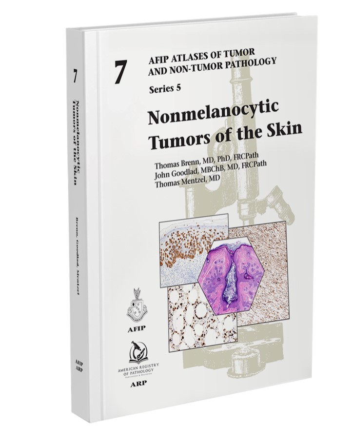 A new series is starting! 

Sharing images picked by ARP CEO Ron DeLellis from Nonmelanocytic Tumors #Skin by Drs. Thomas Brenn, MD, PhD, FRCPath; John Goodlad, MD; Thomas Mentzel, MD. 

Book info: arppress.org.

#skinpath #dermpath #pathology #tumor #pathresidents