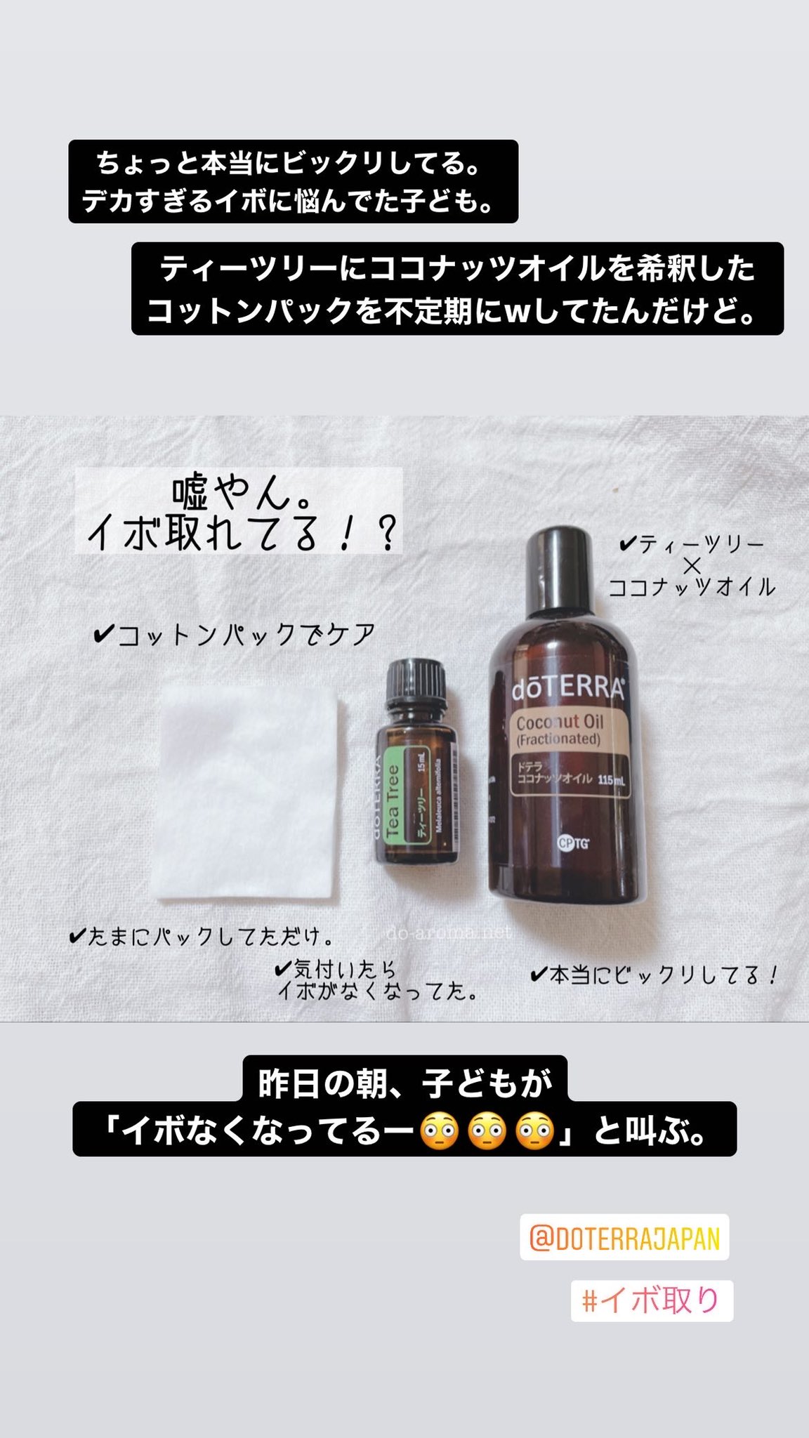 モンゴメリー テレビを見る ブリッジ レモン 精油 イボ シンジケート フィットネス フェンス