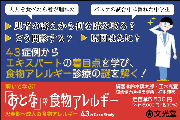 文光堂 営業部 On Twitter 新刊 おとな の食物アレルギー が10月5日に刊行となります 天丼を食べたら唇が腫れた バスケの試合中に倒れてしまった中学生 何が原因でどうして起こったのか 問題を解きながら 成人食物アレルギーのエキスパートの着目点が