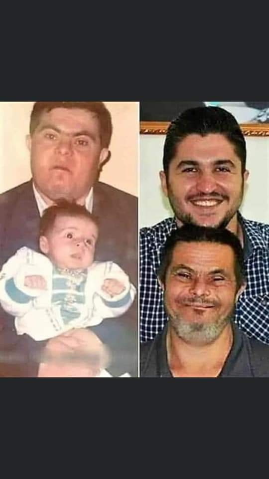 25 yıl fabrikada çalışıp oğlunu büyütüp doktor olmasını sağlayan down sendromlu bir baba ve babasıyla gurur duyan bir evlat. Aha da mutluluğun resmi