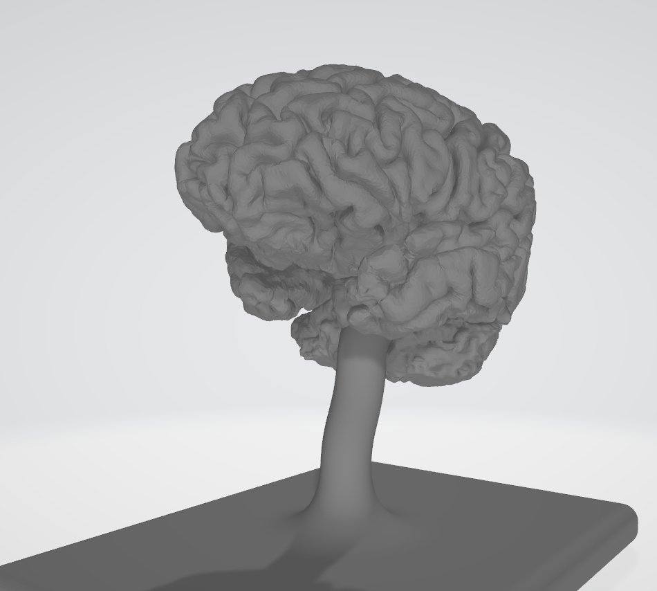 DeamonSol's tweet image. Got this beast of Supercomputer finally in 3d form #MND / #ALS  can't stop this beauty from doing what it does best !!
Going to make one hell of an urn when the time comes