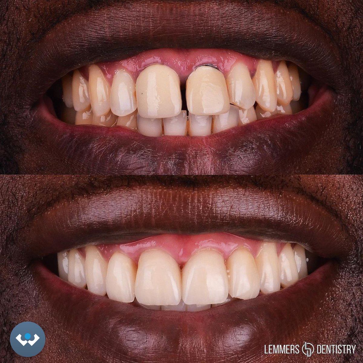 Excent Tandtechniek tweet media