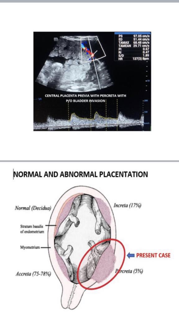 Sardar Vallabhbhai Patel Hospital tweet media