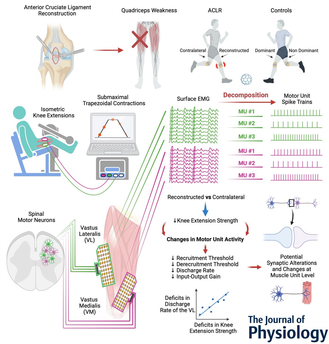 Deborah Falla (@deb_falla) on Twitter photo 🔥HOT OFF THE PRESS🔥 Just accepted in <a href="/JPhysiol/">Journal of Physiology</a>
Deficit in knee extension strength following anterior cruciate ligament reconstruction is explained by a reduced neural drive to the vasti muscles. Congratulations to first author <a href="/snuccio87/">Stefano Nuccio</a> for this outstanding work. 👏 🔥HOT OFF THE PRESS🔥 Just accepted in <a href="/JPhysiol/">Journal of Physiology</a>
Deficit in knee extension strength following anterior cruciate ligament reconstruction is explained by a reduced neural drive to the vasti muscles. Congratulations to first author <a href="/snuccio87/">Stefano Nuccio</a> for this outstanding work. 👏