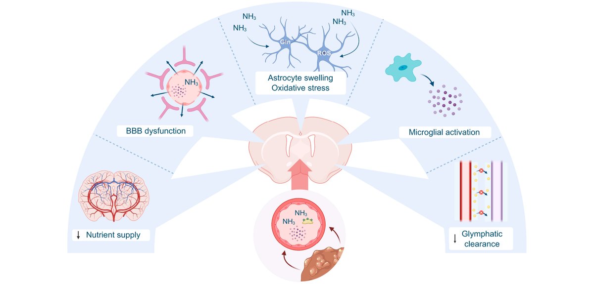 Vdb_lab's tweet photo. #Hepaticencephalopathy is more than just astrocytes, but affects the whole brain! Want to know more? Check out the recent review by @ClaeysWouter  published in @JHEP_Reports.

https://t.co/gqlhqzuH7U https://t.co/k8L3DInbiw
