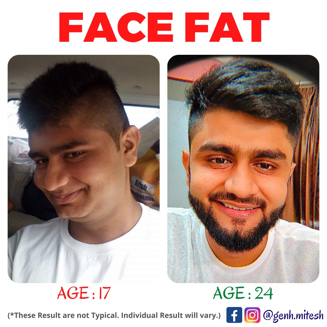 risewithmitesh's tweet photo. 𝐑𝐄𝐒𝐏𝐎𝐍𝐒𝐈𝐁𝐈𝐋𝐈𝐓𝐘 : 𝙸𝚝 𝚒𝚜 𝚈𝚘𝚞𝚛 𝙳𝚞𝚝𝚢 𝚝𝚘 𝙱𝚎𝚌𝚘𝚖𝚎 𝚝𝚑𝚎 𝙱𝚎𝚜𝚝 𝚅𝚎𝚛𝚜𝚒𝚘𝚗 𝚘𝚏 𝚈𝚘𝚞𝚛𝚜𝚎𝚕𝚏 ♥️..𝗙𝗔𝗧 𝘁𝗼 𝗙𝗜𝗧🤩
#facefatloss #fatloss #weightloss #facefat #feelyoung #transformationthursday #bethebestversionofyourself #CoachMitesh #GenH https://t.co/9KnIL8C3HZ