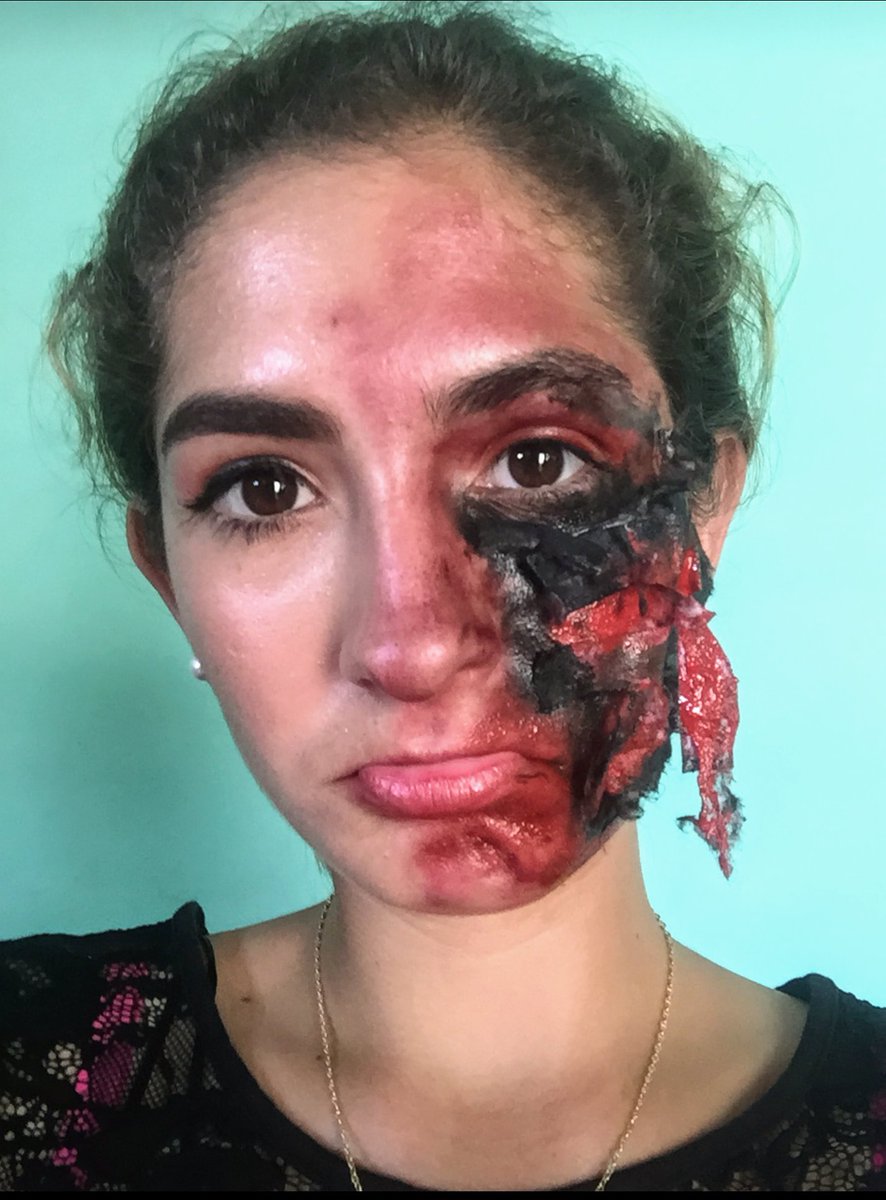 Evelyn20020430's tweet photo. Hola!🌼
Quiero compartir con ustedes un maquillaje de caracterización que me hice hace años, me gustaría saber qué opinan por aquí, fue para un trabajo de la escuela el cual represente una quemadura de 3do grado en la cara 😁. Espero les guste. https://t.co/YJHaQouyAI